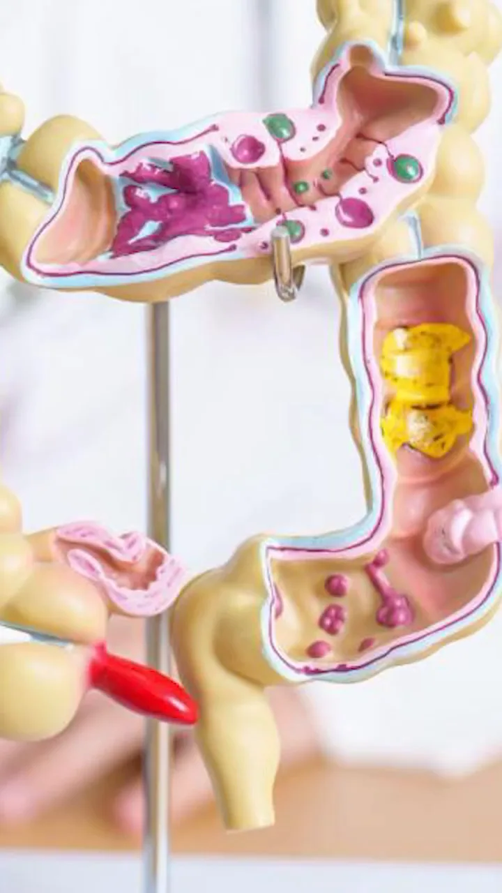 Modelo anatómico del colon en el consultorio